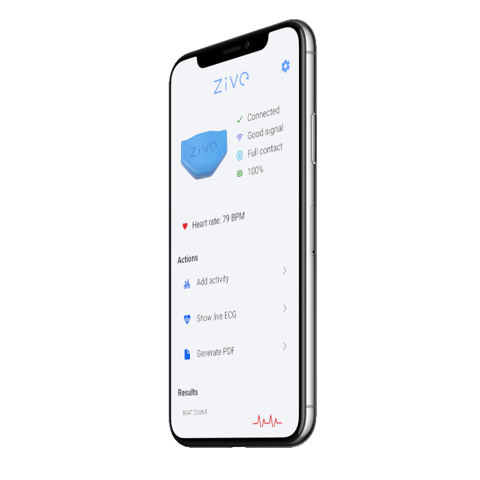 Holter monitor ZIVE ECG with AI based analysis software